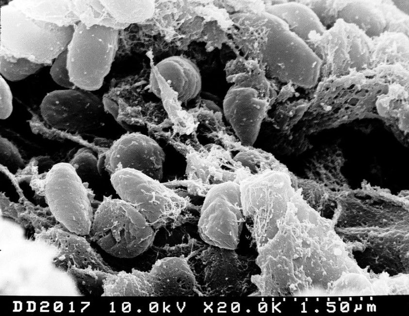 Microscopic image of the Pestis bacteria that caused the Bubonic plague