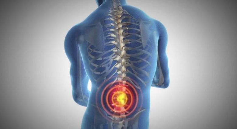 How Back Pain Can Affect Your Lifestyle