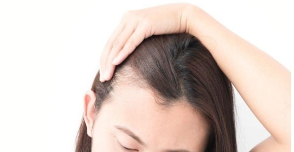 early signs of hair loss