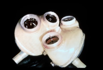 Jarvik-7: The First Successful Artificial Heart