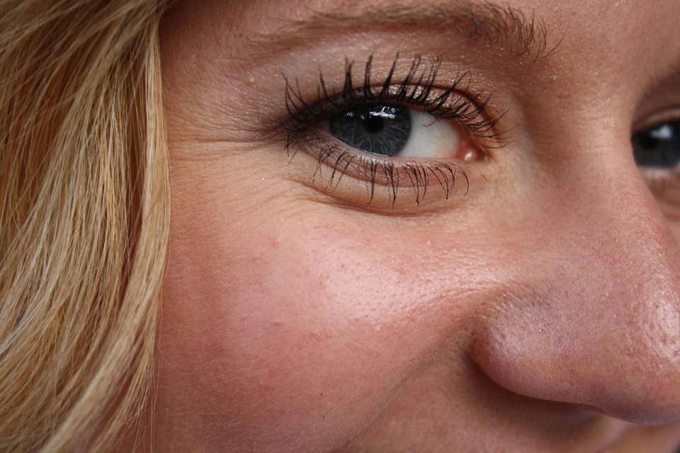 wrinkles on the eye area