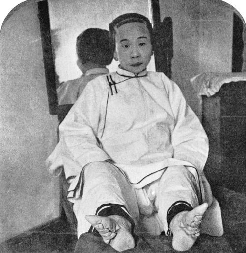A Chinese woman with her feet unwrapped