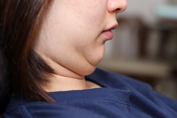 Double Chin Reduction Exercises