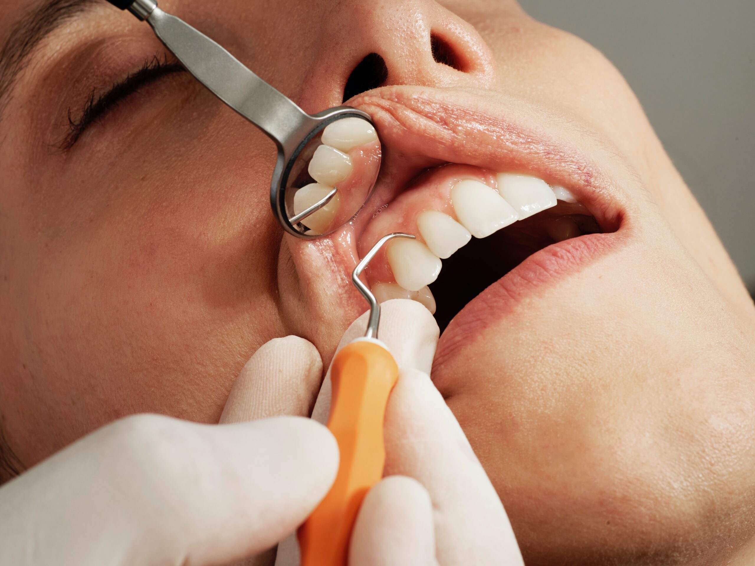 Dentist-Dental-Drill-Dentistry-Dental-Surgery