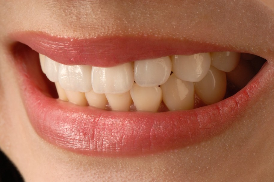 How to Choose the Right Veneer for Your Smile