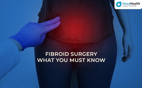 Fibroid surgery