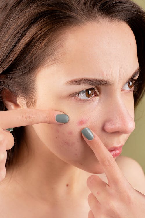 Is Your Pillow Case Causing Acne 6 Ways You Can Help