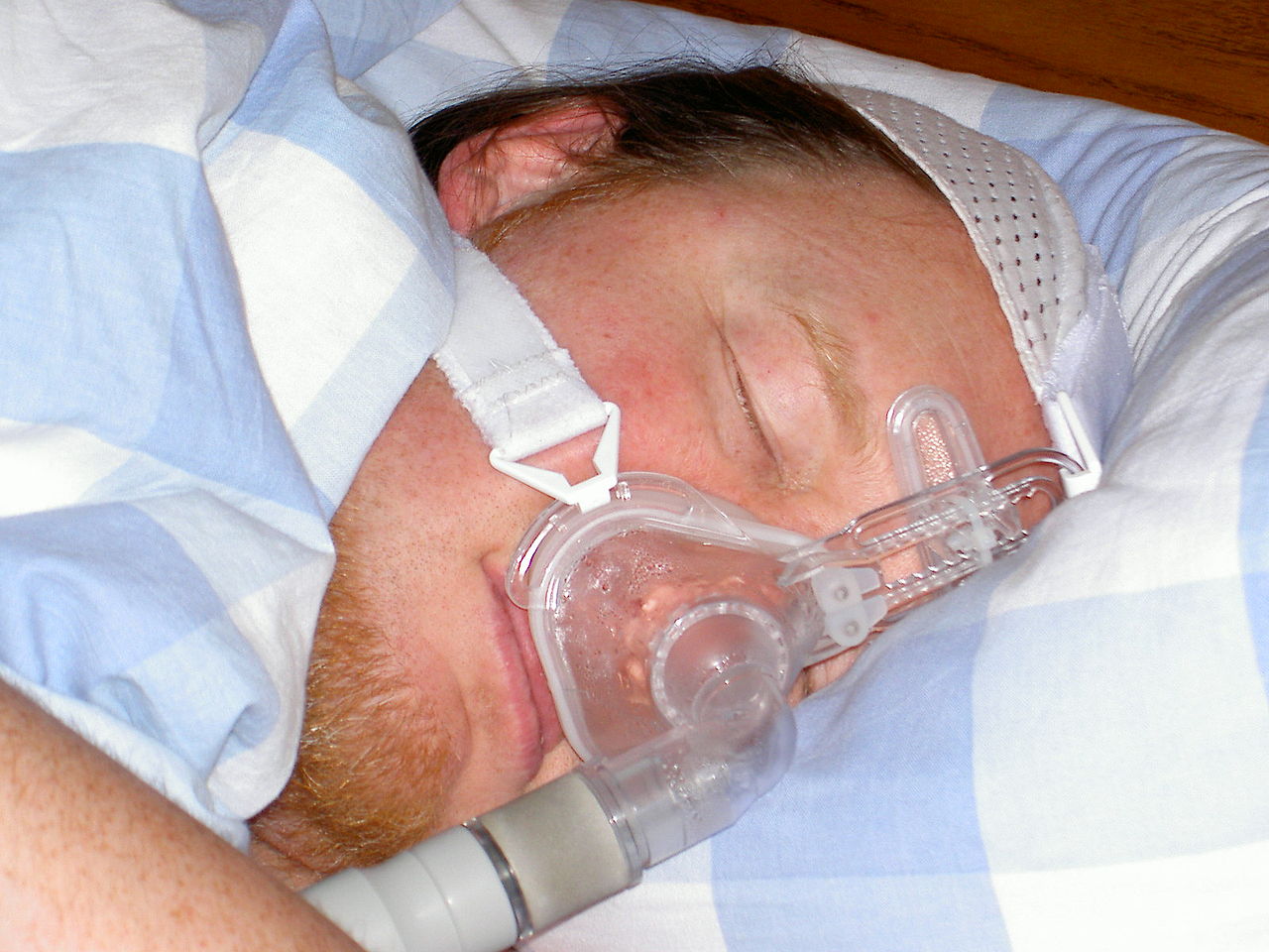 Full-Face Vs. Nasal CPAP Mask Examining The Differences