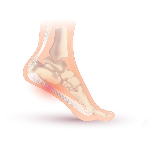 Stretching exercises are ideal for getting relief from plantar fasciitis!