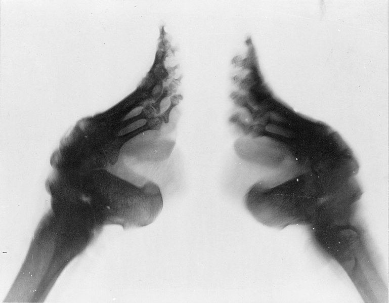 An X-ray of two bound feet